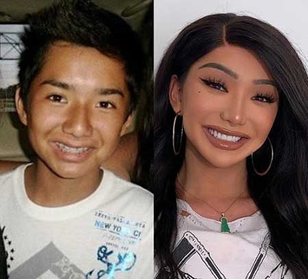   Nikita Dragun prima (a sinistra) e dopo (a destra) il suo intervento chirurgico di riassegnazione di genere