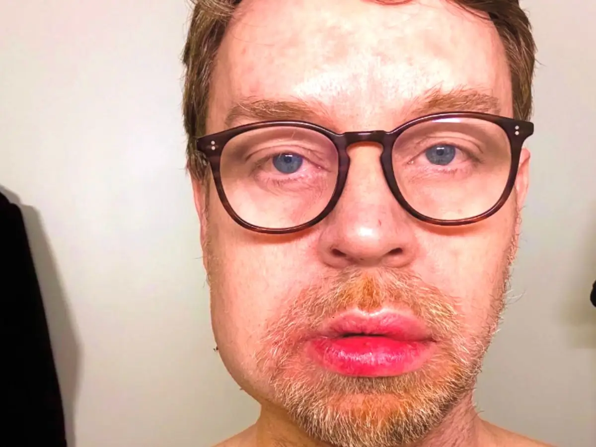 Darren Hayes, do Savage Garden, descreve uma lesão potencialmente fatal: pode estar morto